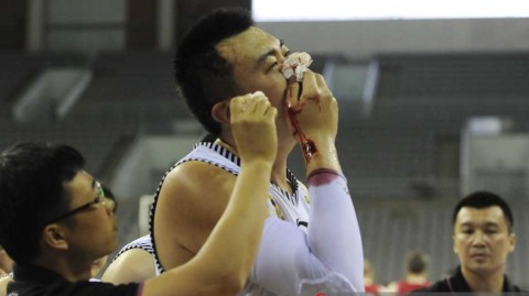 铁血硬汉韩德君赛场血染风采 鼻骨断裂不改擎天柱本色