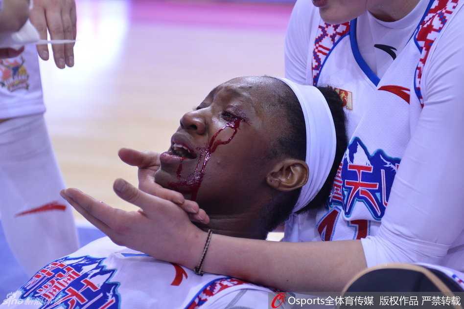 WCBA总决赛浴血战场:新疆外援查尔斯眼角开裂,用坚韧定义“新疆精神” 赛场地板上的血迹触目惊心,见证了这场总决赛的残酷与惨烈,也见证了查尔斯战斗到最后一刻的英勇。