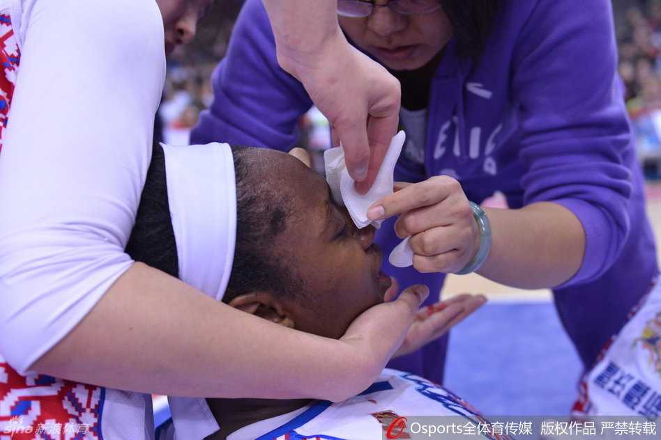 WCBA总决赛浴血战场:新疆外援查尔斯眼角开裂,用坚韧定义“新疆精神” 队医紧急进场为查尔斯处理伤口,白色的纱布瞬间被鲜血染红,查尔斯紧闭双眼忍受着剧痛。