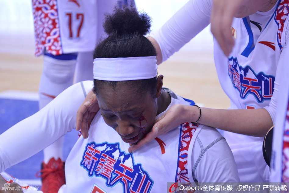 WCBA总决赛浴血战场:新疆外援查尔斯眼角开裂,用坚韧定义“新疆精神” 比赛进入白热化,新疆与北京的球员在篮下进行高强度对抗,火药味十足,每个人都为了球权奋不顾身。