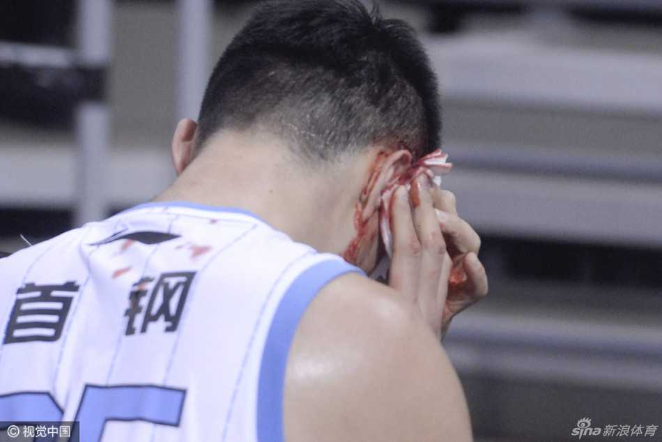 张松涛戴着白色保护头套坐在场边，与队友孙悦有说有笑，心情轻松