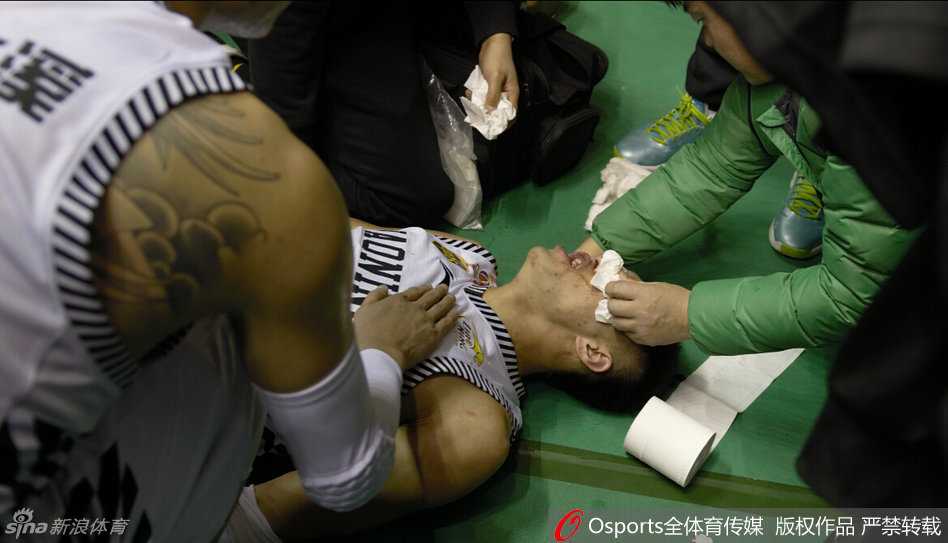 受伤瞬间，郭艾伦应声倒地，双手紧紧捂住血流不止的面部，身旁的队友们瞬间围拢，脸上写满了惊愕与担忧。