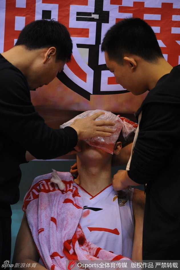 虚化背景前，付豪受伤的特写镜头触目惊心，满脸的血迹遮掩不住他眼神中的茫然与痛苦，这一幕成为了CBA赛场上关于拼搏与代价的经典定格。