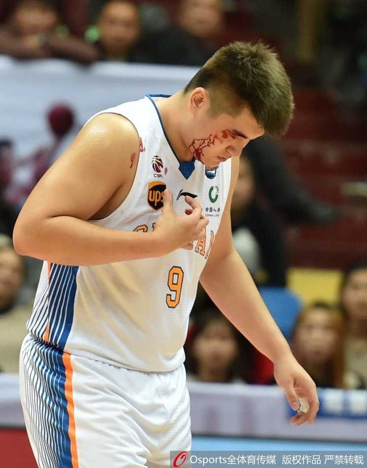 眉骨开裂血染战袍 四川内线徐煜峰浴血奋战的夜晚 徐煜峰眉骨开裂瞬间,鲜血顺流而下,他紧皱眉头用手捂住伤口,眼神中透露出一丝不甘