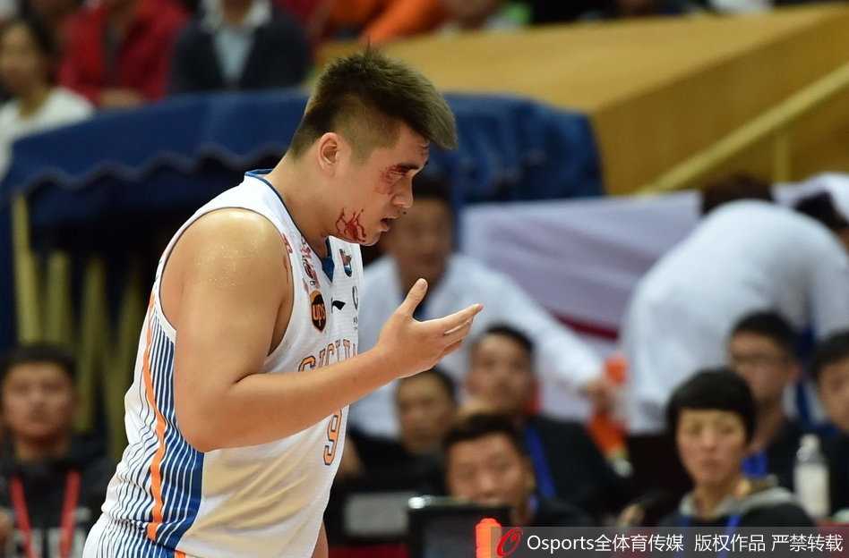 眉骨开裂血染战袍 四川内线徐煜峰浴血奋战的夜晚 鲜血浸透了徐煜峰胸前的球衣,他在简单包扎后依然坚持战斗,球衣上的斑斑血迹记录着这场比赛的惨烈