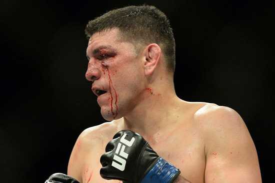 蜘蛛席尔瓦归来！尼克迪亚兹激战五回合落败